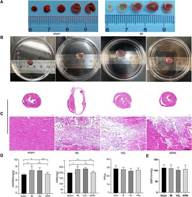 Lcz696 Alleviates Myocardial Fibrosis After Myocardial Infarction Through the sFRP-1/Wnt/β-Catenin Signaling Pathway